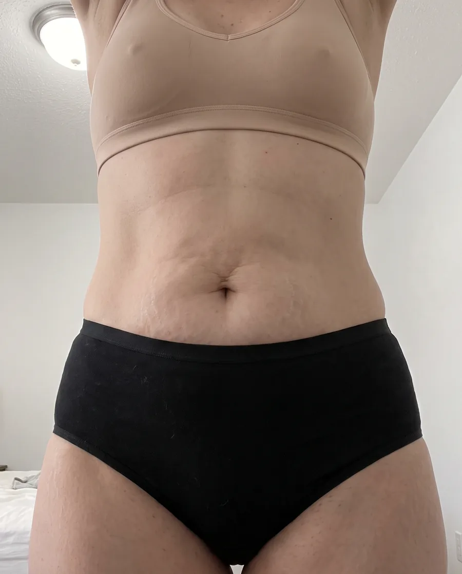 Barriga com pele menos firme depois de emagrecer